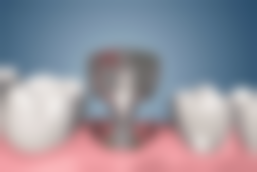 烟台海阳禾普口腔诊所真实实例