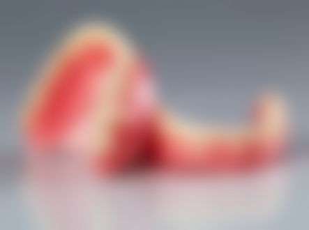 山西太原华城口腔真实实例：见证神奇的口腔蜕变