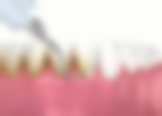 烟台海阳禾普口腔诊所擅长项目