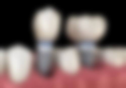 深圳陈闯口腔诊所口碑怎么样