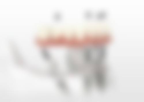 广东东莞常平星超口腔擅长项目