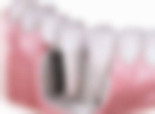 榆林特美口腔(富康路店)真实实例：见证神奇改变