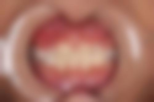 重庆沙坪坝瑞康口腔电话号码