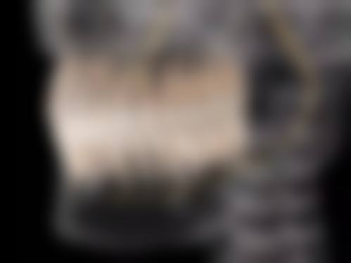 重庆沙坪坝瑞康口腔价格表