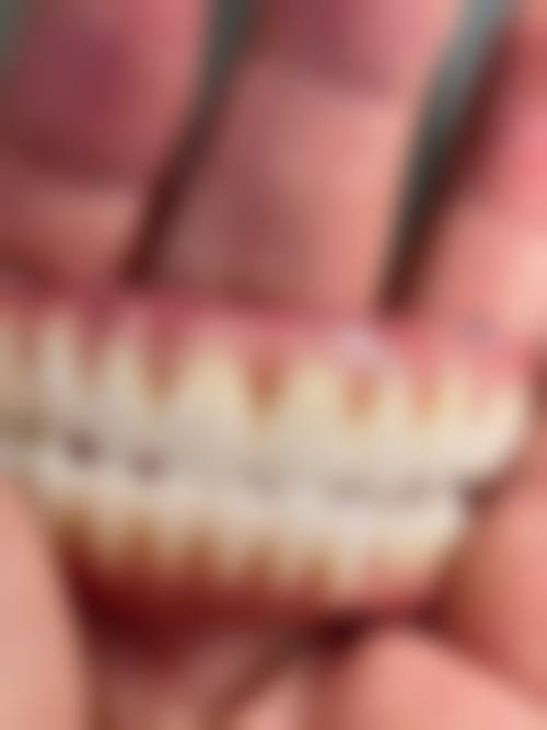 重庆沙坪坝瑞康口腔真实实例