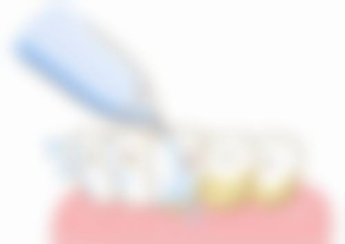 隆回雅贝康口腔医院价格表