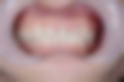 镇江扬中张秋萍口腔诊所医生名单