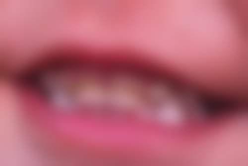 黄琬莹医生擅长项目