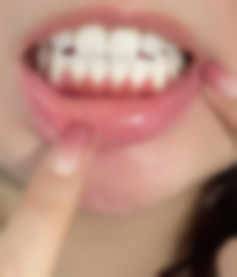 安峰医生技术特点：精良又独特