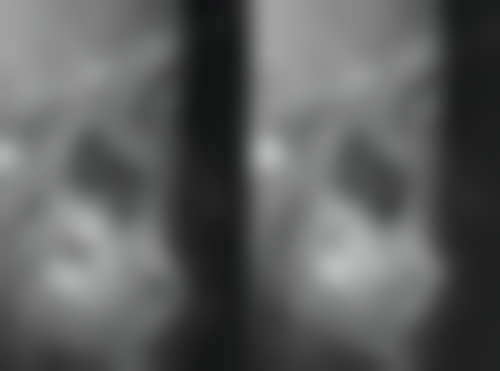 申强医生技术特点