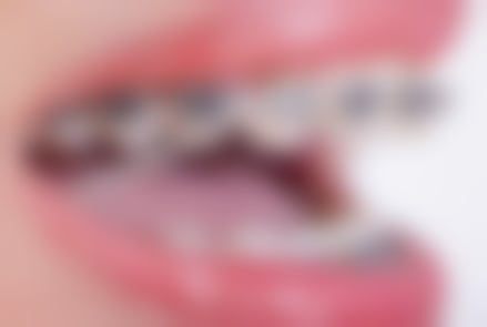 补牙后牙疼用冷敷适合吗