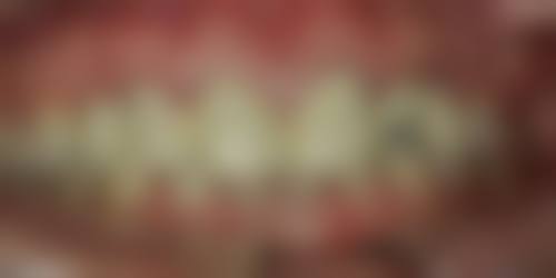 青岛马濠优诺口腔医院（马濠店）口碑怎么样