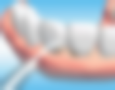 方杰医生真实实例：见证神奇治疗成效