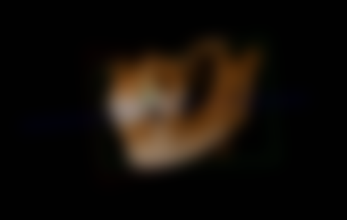 山东菏泽兴华口腔医院价格表