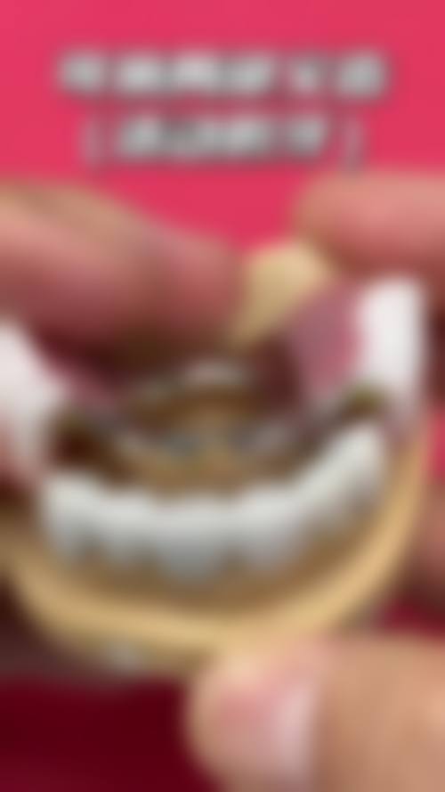 白求恩国内外和平医院口腔科真实实例：见证神奇的口腔蜕变