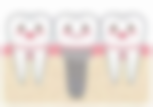 牙齿有小黑点的情况下可以补牙吗