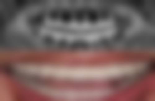 王程医生擅长项目