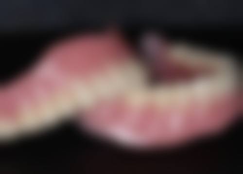 格莱美全瓷牙值不值？