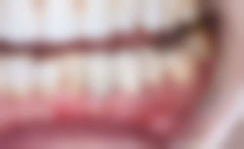 金华雅美口腔仪器设备：精良科技助力治疗