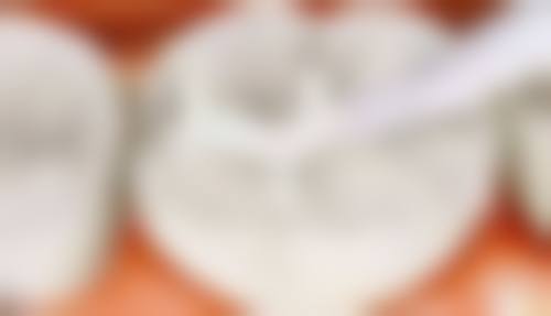 济南槐荫尚豪口腔诊所真实实例