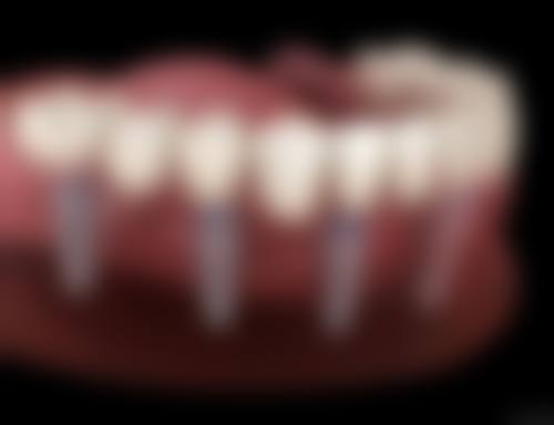 济南槐荫尚豪口腔诊所价格表