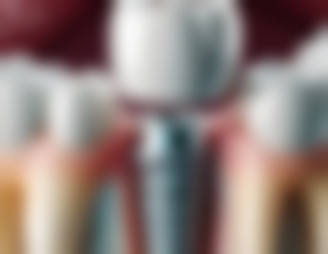 国产全瓷牙品牌的未来发展如何？