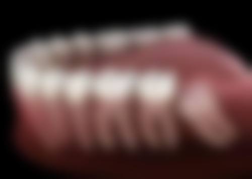 烤瓷牙和真牙的使用寿命一样吗