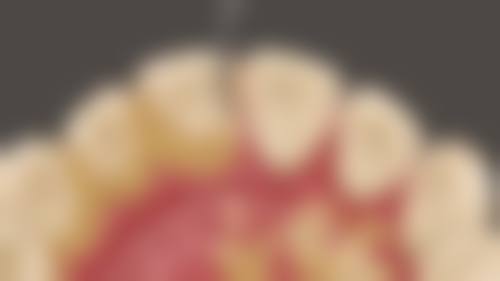 山东威海荣成海鹏口腔口碑怎么样