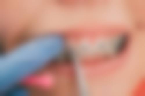 丽水缙云惠雅口腔诊所仪器设备