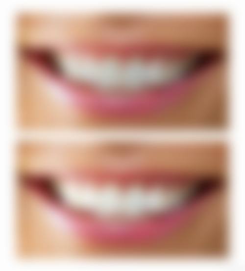 北京马泷齿科连锁口碑怎么样