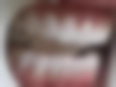 根管治疗后牙齿松动靠自然修复怎么样