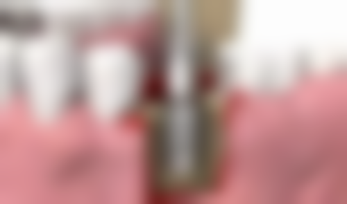 太原皓一口腔医生名单：专精团队为你护航