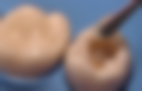 温江贝诗特口腔门诊部真实实例