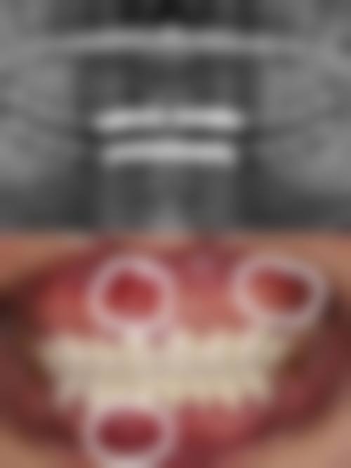 东莞优贝口腔门诊部（京港店）真实实例