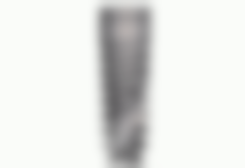 拔牙多年后种牙值不值