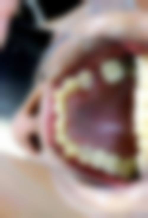 健和口腔门诊部价格表：合理的收费标准