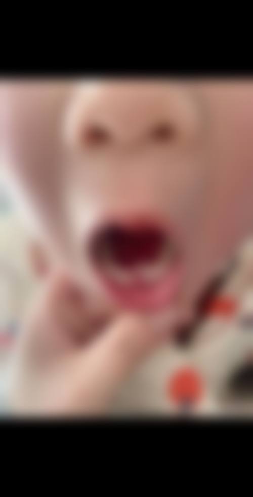 商丘景丰口腔医院预约挂号方式