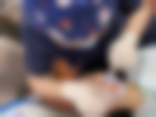 济南槐荫洁益康口腔诊所真实实例