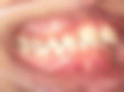成都亚非牙科医院口碑怎么样
