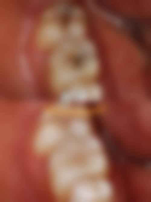 沈阳铁西美树口腔擅长项目