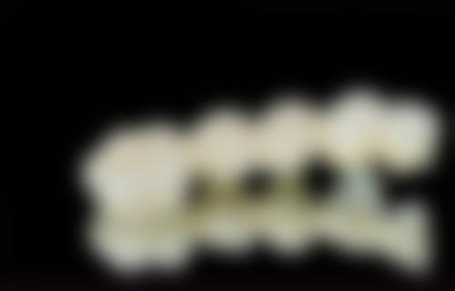 北京益赛尔口腔真实实例:见证神奇成效