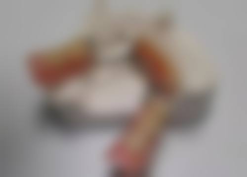 全瓷牙套做核磁共振有什么优势