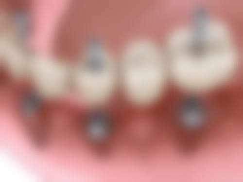 吴忠市利通区付亚栋口腔诊所真实实例