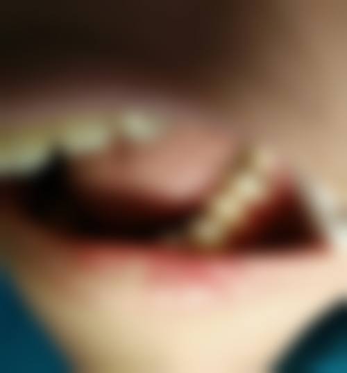 苏州维婷启航口腔诊所价格表