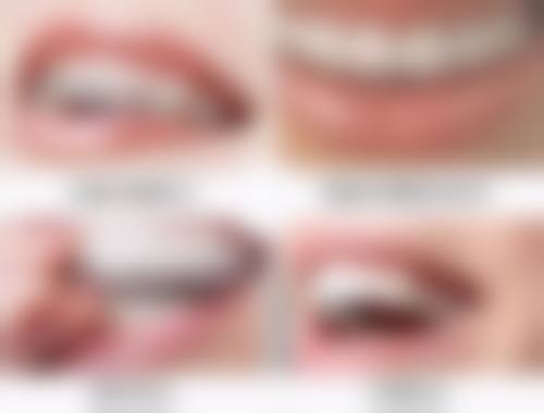 如何确保塑料活动义齿安心无毒