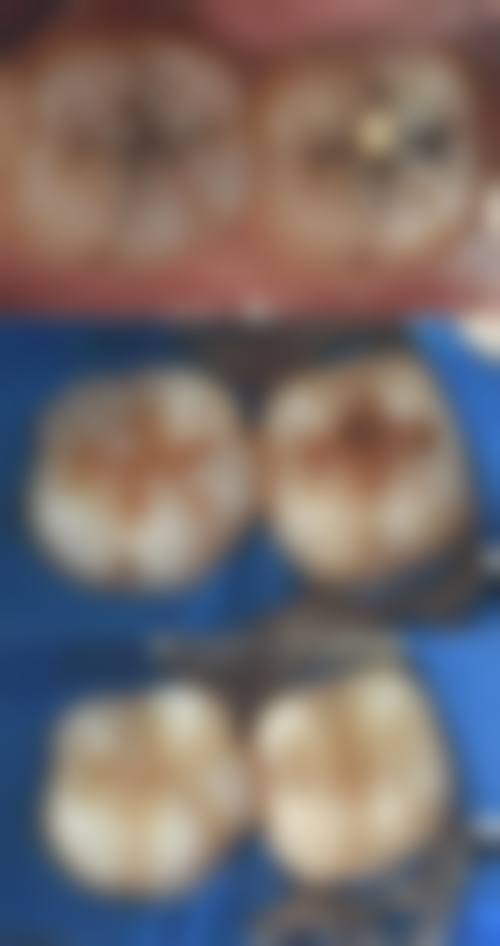 廊坊霸州鲨齿口腔口碑怎么样