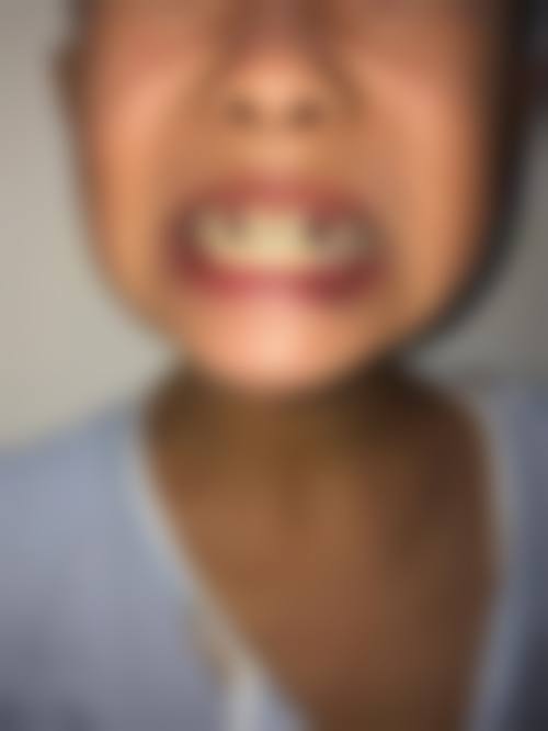 深圳迈兔口腔诊所价格表
