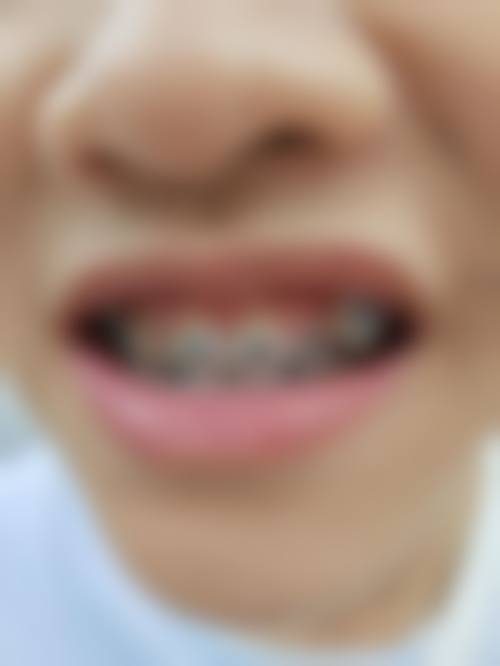 成都伯菲口腔诊所口碑怎么样