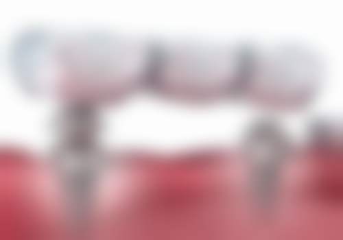 桂林牙博士口腔价格表:性价比极高的“护牙套餐”