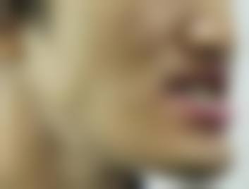 大同精典口腔门诊部(北城分院)价格表